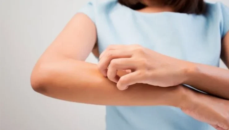 UYUZ VAKALARI ARTIYOR