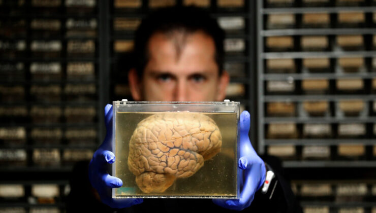 Bilim dünyasında ilk! Beyin bedenden ayrı canlı tutuldu
