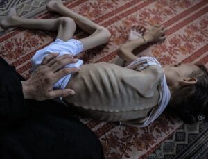 Gazze’de 2’si çocuk 7 Filistinli açlıktan hayatını kaybetti