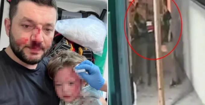 Yalova’da baba ile 14 aylık bebeğinin darbedildiği görüntüler ortaya çıktı