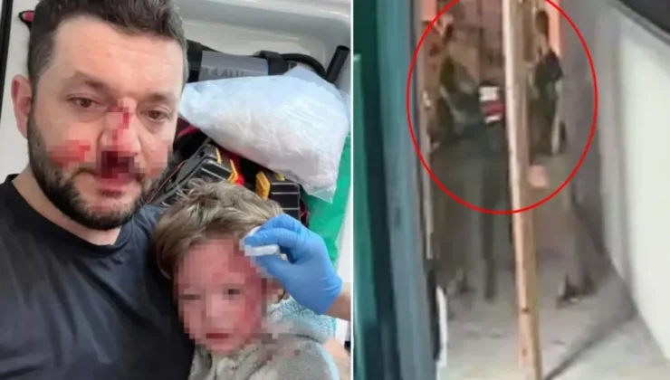 Yalova’da baba ile 14 aylık bebeğinin darbedildiği görüntüler ortaya çıktı