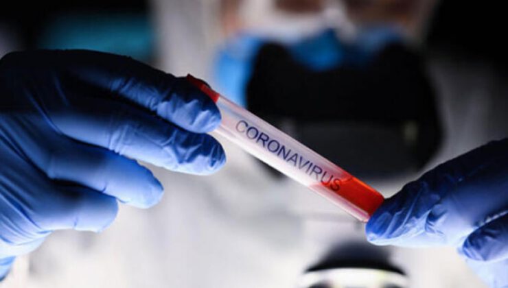 Türkiye’de koronavirüsten can kaybı 10 bin 99 oldu
